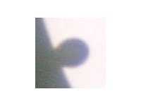 Fig 18. Extreme teardrop at 3rd contact.