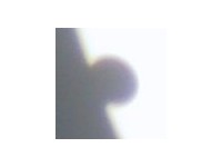 Fig 19. Extreme teardrop at 3rd contact.